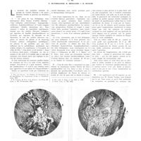 0793 - Page 789 - Travaux originaux. À quel moment après la première injection de parathormone de glucose ou de plomb voit-on apparaître. Les premiers signes d'ostéite fibreuse. Par MM. E. Rutishauser, R. Broccard et M. Bianchi