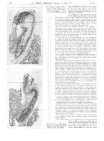 Fig. 2. (coupe 9). (coupes de Mademoiselle L. Guyon. Microph. de Mme L. François-Franck). 1 : Greffe [...]