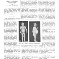 0861 - Page 857 - Travaux originaux. L'hépatomégalie polycorique. Par MM. Robert Debré et G. Sémelaigne