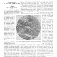 0901 - Page 897 - Travaux originaux. Tuberculose de la glande sous-maxillaire. Par H. Mondor et Mlle P. Gauthier-Villars