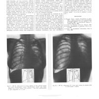 0954 - Page 950 - Travaux originaux. Le pneumothorax contro-latéral. Par MM. Tobé, Degeorges, Salmon et Joly... / Bibliographie