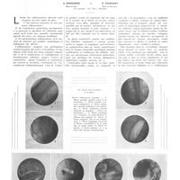1079 - Page 1069 - Travaux originaux. Les inflammations pleurales (Contribution photo et micro-photographique). Par MM. G. Derscheid... et P. Toussaint...