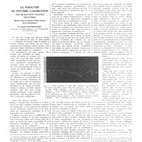 1091 - Page 1081 - Travaux originaux. La paralysie du système vasomoteur par les solvants volatils industriels (Benzol, éther de pétrole, acétate d'amyle, vernis cellulosique). Par Lucien Dautrebande...