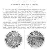 1175 - Page 1169 - Travaux originaux. Considération cliniques et anatomo-pathologiques sur le cancer du larynx chez le vieillard. Par MM. Georges Portmann, Mougneau et Barraud