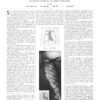 1188 - Page 1182 - Travaux originaux. Formes cliniques et radiologiques des kystes aériens du poumon de moyen volume et de forme annulaire. Par MM. Pierre Pruvost, M. Leblanc, Delort et Coletsos