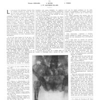 1192 - Page 1186 - Travaux originaux. L'action ou la réaction des parathyroïdes dans l'ostéose cancéreuse diffuse. Par Étienne Bernard, J. Boyer, J. Porge et Mlle Gauthier-Villars