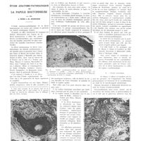 1427 - Page 1425 - Travaux originaux. Étude anatomo-pathologique de la papule boutonneuse. Par MM. J. Piéri et M. Mosinger
