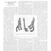 1473 - Page 1473 - Travaux originaux. Les thoracoplasties itératives. Par P. Dreyfus-le Foyer