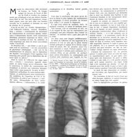 1539 - Page 1541 - Travaux originaux. Les vomissements par aérophagie chez le nourrisson de moins de six mois. Par MM. P. Lereboullet, Marcel Lelong et P. Aimé