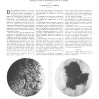1553 - Page 1555 - Travaux originaux. Action cytotoxique de certains métaux sur des ostéoblastes humains cultivés «in vitro». Contribution à l'étude de l'ostéosynthèse au point de vue biologique. Par MM. G. Menegaux et D. Odiette