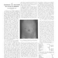 1559 - Page 1561 - Travaux originaux. Le diagnostic du Kala-Azar par les frottis dermiques. Par Ed. Benhamou...