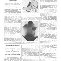 1566 - Page 1568 - Travaux originaux. Un nouveau mode de gastro-entérostomie. Premier temps de gastrectomie. Par Robert-Didier / Laboratoire et clinique. Le diagnostic rapide des troubles humoraux de la maladie post-opératoire