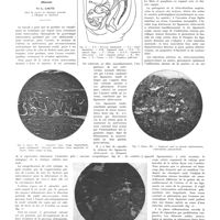 1626 - Page 1628 - Travaux originaux. Systématisation de la ligamentopexie en gynécologie conservatrice. (Résumé). Par L. Loute...