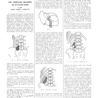 1661 - Page 1665 - Travaux originaux. Les vésicules biliaires en situation basse. Par MM. Faroy, Deron et Carlotti