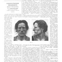 1668 - Page 1672 - Travaux originaux. À propos du diagnostic du tabes fruste. Les aréflexies tendineuses, les troubles sensitifs et trophiques pouvant accompagner les malformations du rachis lombo-sacré (Spina-bifida occulta et sacralisation de la 5e vertèbre lombaire). Par MM. Jacques Decourt et Maurice Coste / Lipodystrophie progressive. (Syndrome de Barraquer-Simons). Par L. Barraquer-Ferré...