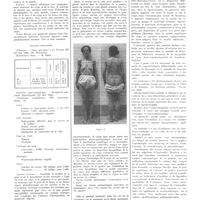 1669 - Page 1673 - Travaux originaux. Lipodystrophie progressive (Syndrome de Barraquer-Simons). Par L. Barraquer-Ferré... / Bibliographie