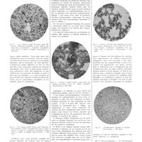 1765 - Page 1771 - Travaux originaux. Une importante voie nouvelle ouverte en thérapeutique. La granulothérapie. Par Auguste Lumière...