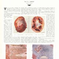 1797 - Page 1804 - Travaux originaux. Tumeur du corpuscule carotidien. Par P. L. Mirizzi...