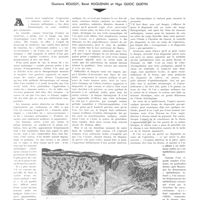 1801 - Page 1808 - Travaux originaux. Les tumeurs noires de la peau. Par MM. Gustave Roussy, René Huguenin et Ngo Quoc Queyn