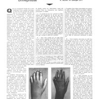 1811 - Page 1818 - Travaux originaux. Essais de vaccinothérapie antilépreuse. Par MM. A. Sézary et Georges Lévy