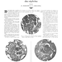 1818 - Page 1825 - Travaux originaux. Intérêt pratique d'une classification anatomo-pathologique des néphrites. Par MM. H. Chabanier et C. Lobo-Onell
