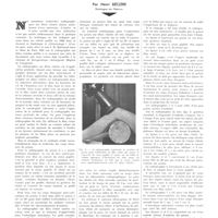 1832 - Page 1839 - Travaux originaux. La radiographie sur films cintrés pour la recherche des corps étrangers du genou. Par Henri Béclère...