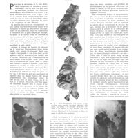 2070 - Page 2081 - Travaux originaux. Physiologie radiologique de la valvule iléo-caecale. Par MM. M. Chiray et A. Bosquet