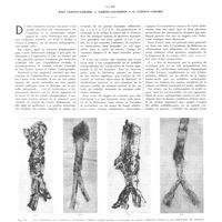 2073 - Page 2084 - Travaux originaux. Le radiodiagnostic des calcifications de l'aorte abdominale et de ses branches. Par MM. René Ledoux-Lebard, J. Garcia-Calderon et G. Ledoux-Lebard