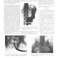 2076 - Page 2087 - Travaux originaux. Le radiodiagnostic des calcifications de l'aorte abdominale et de ses branches. Par MM. René Ledoux-Lebard, J. Garcia-Calderon et G. Ledoux-Lebard / Bibliographie