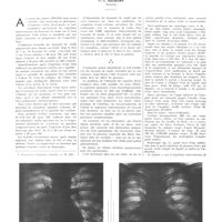 2083 - Page 2094 - Travaux originaux. Le traitement des abcès et des gangrènes du poumon par injections intraveineuses de benzoate de soude. Par L. Goldkorn...