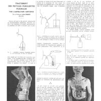 0021 - Page 17 - Travaux originaux. Traitement des fistules purulentes pleurales par l'aspiration continue. Par le professeur Léon Imbert...