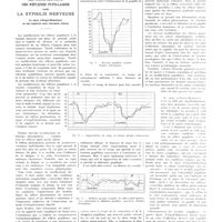 0025 - Page 21 - Mouvement médical. Les modifications des réflexes pupillaires dans la syphilis nerveuse. Le signe d'Argyll-Robertson et ses rapports avec l'atrophie Irienne