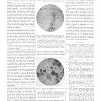 0127 - Page 123 - Travaux originaux. Le diagnostic rapide des pneumococcies. L'épreuve du péritoine de la souris. Par MM. Jean Troisier, M. Bariéty et G. Brouet / Bibliographie