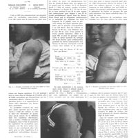 0143 - Page 139 - Travaux originaux. Virus antivarioliques purs et vaccination sous-cutanée. Par MM. Eduardo Gallardo... et Julian Sanz