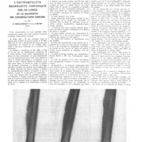 0213 - Page 209 - Travaux originaux. L'ostéomyélite éburnante chronique des os longs et le diagnostic des condensations osseuses. Par MM. P. Moulonguet et J.-A. Lièvre...