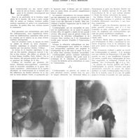 0441 - Page 437 - Travaux originaux. L'arthrographie dans la luxation congénitale de la hanche. Par MM. Jacques Leveuf et Pierre Bertrand