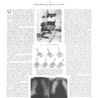 0445 - Page 441 - Travaux originaux. La radiographie limitée à un plan (Tomographie). Son intérêt dans l'étude des lésions pulmonaires. Par MM. Etienne Bernard, Mc Dougall et A. Camino