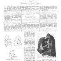 0448 - Page 444 - Travaux originaux. La trame primaire des poumons et la destination corticale de ses ramifications. Étude anatomique, radiologique et clinique. Par MM. R. Grandgérard... et R. Heim de Balsac...