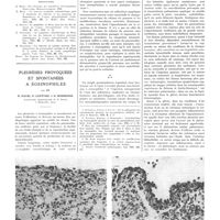 0498 - Page 494 - Travaux originaux. Valeur clinique d'un symptôme d'origine sympathique dans les tumeurs et les processus inflammatoires de l'espace rétro-péritonéal. Par le Prof. E. Hesse... / Bibliographie / Pleurésies provoquées et spontanées à éosinophiles. Par MM. P. Pavie, P. Lefèvre et G. Rossignol...