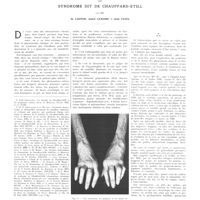 0629 - Page 625 - Travaux originaux. Sur le traitement par la splénectomie du syndrome dit de Chauffard-Still. Par MM. M. Loeper, André Lemaire et Jean Patel