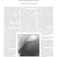 0632 - Page 628 - Travaux originaux. L'ulcère de la face postérieure de l'estomac (Ulcère sous-tubérositaire) et son diagnostic radiologique. Par MM. R. Ledoux-Lebard et J. Garcia-Calderon