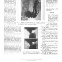 0634 - Page 630 - Travaux originaux. L'ulcère de la face postérieure de l'estomac (Ulcère sous-tubérositaire) et son diagnostic radiologique. Par MM. R. Ledoux-Lebard et J. Garcia-Calderon / Bibliographie