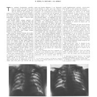 0635 - Page 631 - Travaux originaux. Examen radiologique des poumons en position couchée. Par MM. R. Benda, H. Mollard et Ch. Debray