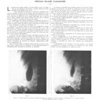 0643 - Page 639 - La radiologie du praticien. Par MM. J. Belot et L. Nahan. Vésicule biliaire cloisonnée