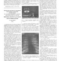 0705 - Page 701 - Travaux originaux. Intérêt de l'étude des lipidoses pour la neuropathologie. II. Les lipidoses à cérébrosides. Par Ludo Van Bogaert / Réalisation pratique et économique des examens pulmonaires systématiques et systématiquement répétés des collectivités au travail, mesure prophylactique antituberculeuse. Par Paul Braun...