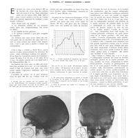 0765 - Page 761 - Travaux originaux. A propos de 109 cas de fractures du crâne chez les enfants. Par E. Sorrel, Mme Sorrel-Dejerine et Gigon