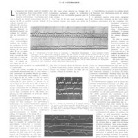 0772 - Page 768 - Travaux originaux. Troubles de conduction du myocarde. Les blocs ascendants