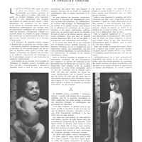 0777 - Page 773 - Mouvement médical. La fragilité osseuse