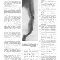 0780 - Page 776 - Mouvement médical. La fragilité osseuse / Bibliographie