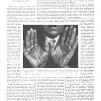 0840 - Page 836 - Travaux originaux. Accidents produits par l'électricité. Par J. Uzac...